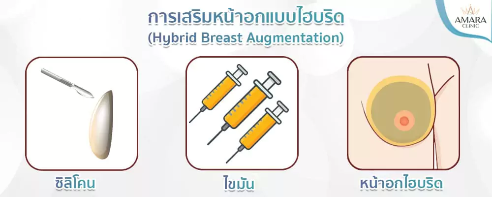 ทำนม เสริมหน้าอก